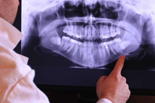 Best Emergency Gum Pain Relief  in Hoer, OK